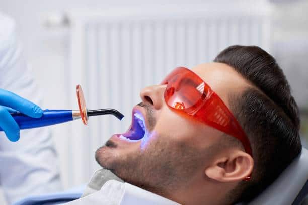 What Happens Inside Your Mouth During a 1 Hour Whitening Session Harlow