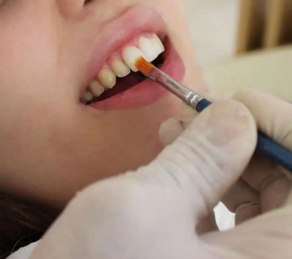 What Are Dental Restorations and How Do They Differ from Natural Teeth Harlow