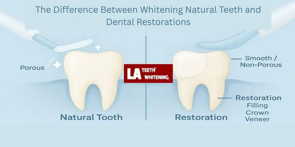 The Difference Between Whitening Natural Teeth and Dental Restorations Harlow